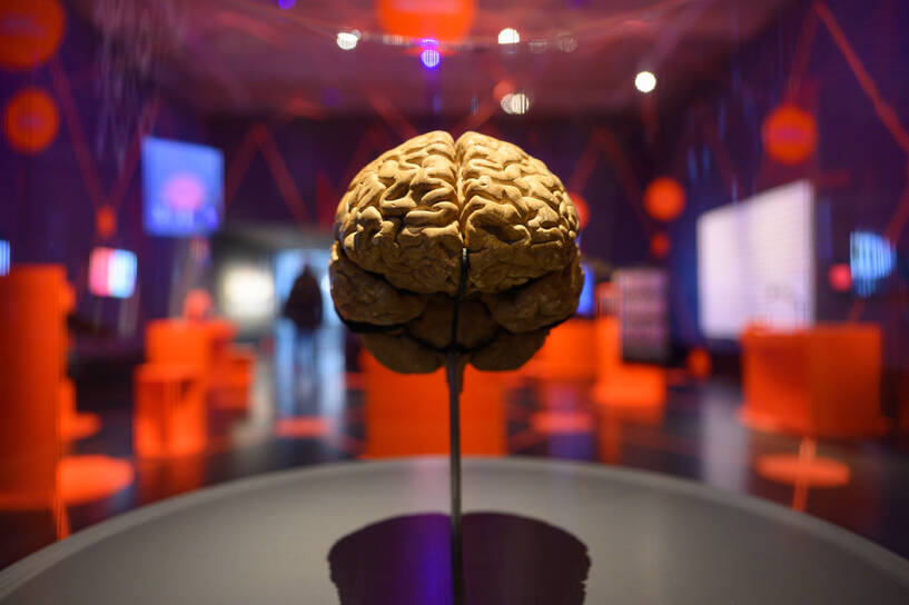 Wystawa w Dreznie, ogólny widok ludzkiego mózgu, fot. PAP/DPA/Robert Michael